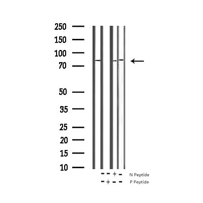 CTTN / Cortactin Antibody (phospho-Tyr466)