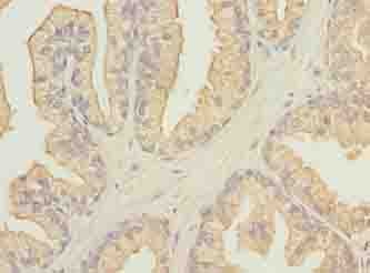 Polyclonal Rabbit anti-Human FAM78A Antibody (IHC, WB)