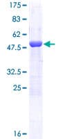 Human MAD2L1 / MAD2 Protein (Recombinant GST)