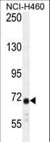 Polyclonal Rabbit anti-Human ATXN7L2 Antibody (aa555-584, WB)