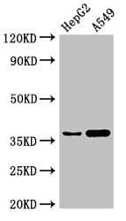 GGH / Gamma-Glutamyl Hydrolase Antibody