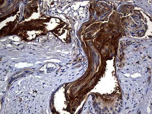 Monoclonal Mouse anti-Human CPM / Carboxypeptidase M Antibody (clone OTI4E11, aa124-423, IHC, WB)