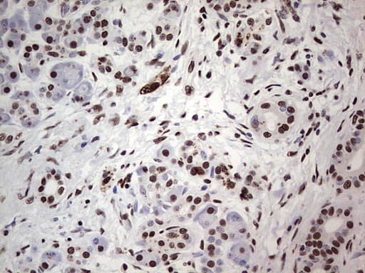 SAE1 Antibody (clone OTI3C3)