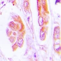 Polyclonal Rabbit anti-Human CASP7 / Caspase 7 Antibody (Internal, IHC, WB)