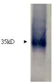 Polyclonal Rabbit anti-Human MMP7 / Matrilysin Antibody (Preservative Free, WB)