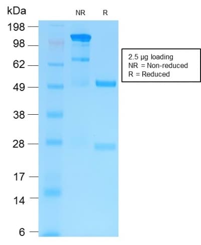 Recombinant Monoclonal Rabbit anti-Human MMP9 / Gelatinase B Antibody (clone MMP9/2025R, Azide-free,Carrier-free, aa 603-614, IHC)