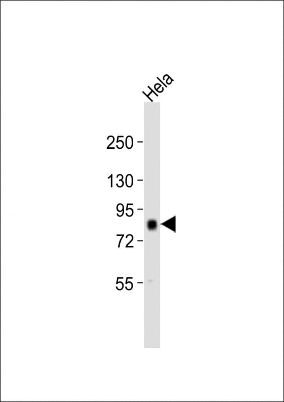AKAP8 / AKAP95 Antibody (aa395-430)