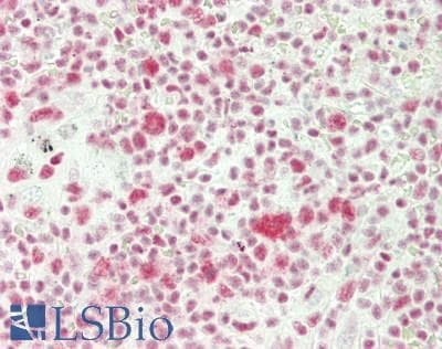 IHC-plus™ NR3C1/Glucocorticoid Receptor Antibody (aa147-196)