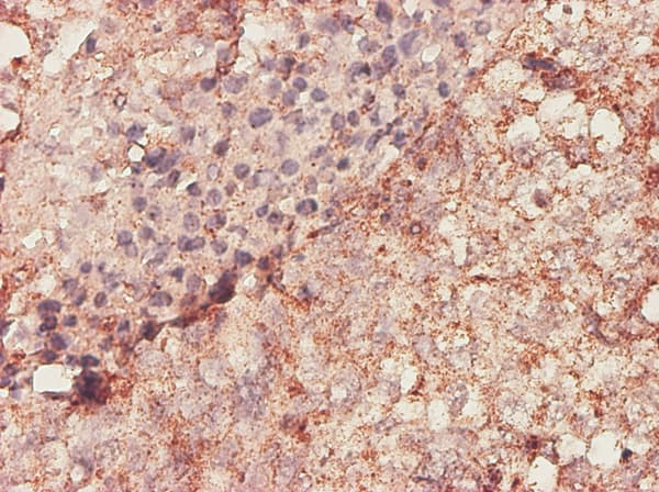 BGN / Biglycan Antibody (clone 4E1-1G7)