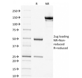 TP63 / p63 Antibody (clone TP63/1786)