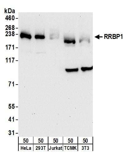IHC-plus™ Polyclonal Rabbit anti-Human XPOT / Exportin-T Antibody (aa825-875, IHC, WB)