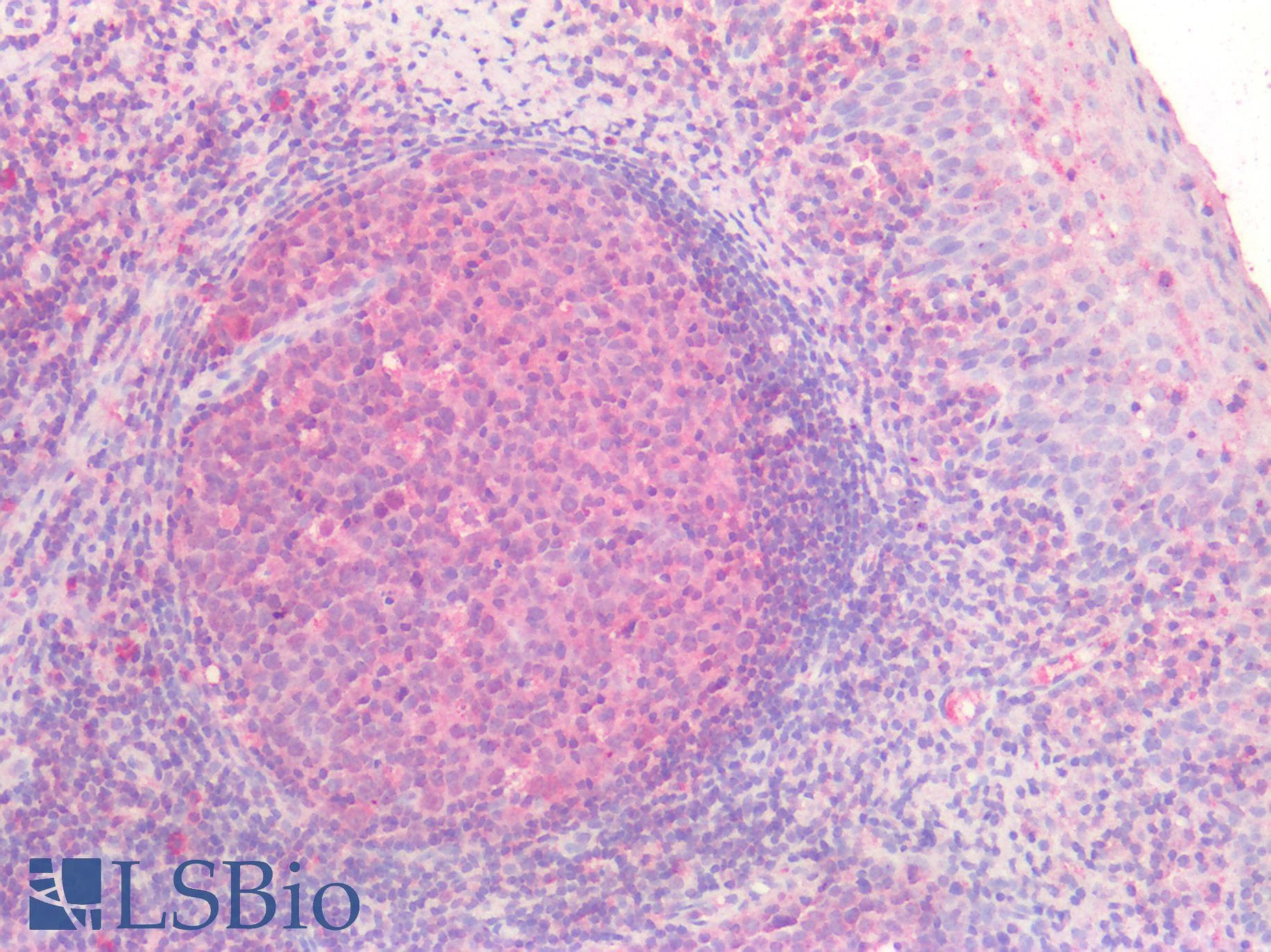PathPlus™ Osteonectin / SPARC Antibody