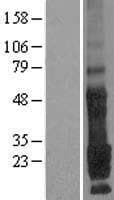 TMEM9 Protein (Over-Expression Lysate Myc-DDK (Flag))