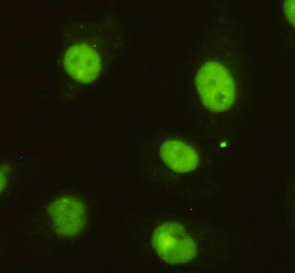 CCAR2 / KIAA1967 Antibody (N-Terminus)