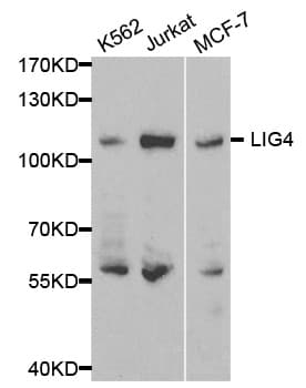 Polyclonal Rabbit anti-Human LIG4 / DNA Ligase IV Antibody (IHC, WB)