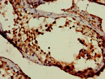 SLC6A13 / GAT-2 Antibody