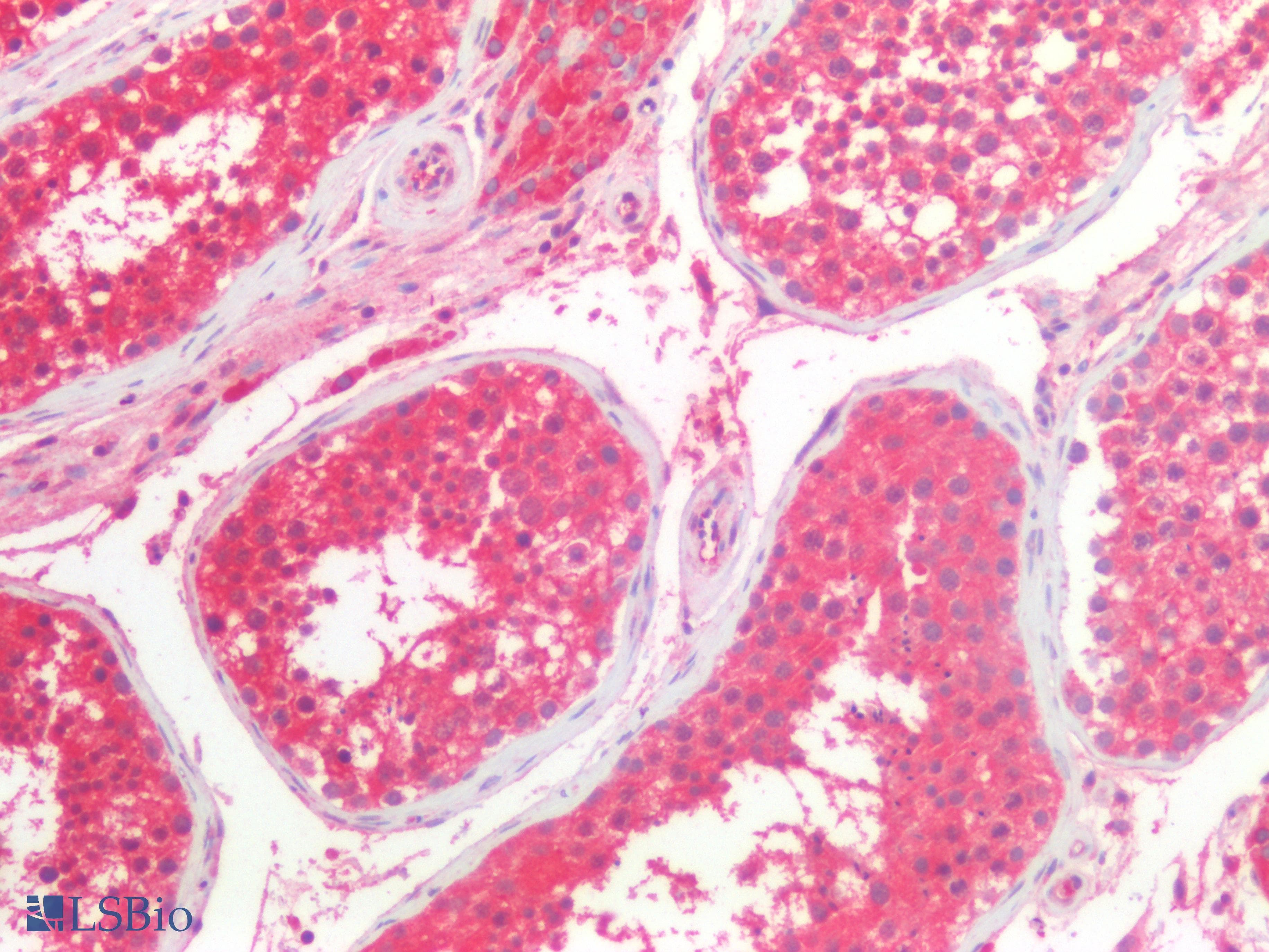PathPlus™ VPS37A Antibody
