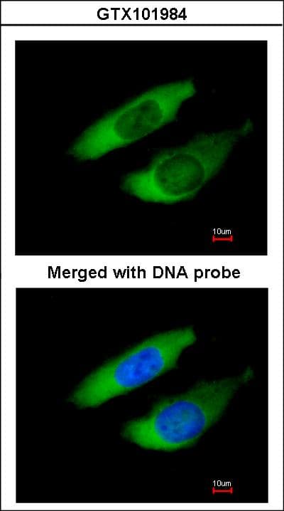 Polyclonal Rabbit anti-Human ARPC2 / p34-Arc Antibody (aa14-300, IHC, WB)