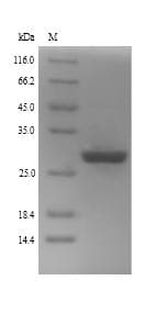 Human GLI2 Protein (Recombinant 6His, N-terminus)