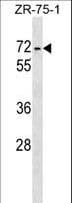 ZKSCAN1 / ZNF36 Antibody (aa238-265)