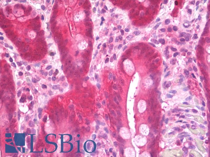 IHC-plus™ DCTPP1 / XTP3TPA Antibody (aa12-40)