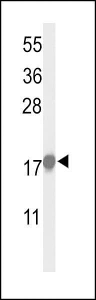 CDKN1A / WAF1 / p21 Antibody (aa105-140)