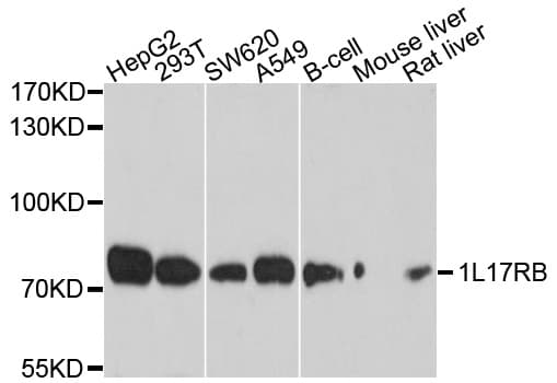 Polyclonal Rabbit anti-Human IL17RB Antibody (WB)