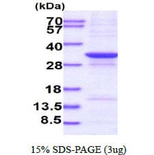 Human NCEH1 / AADACL1 Protein (Recombinant His)