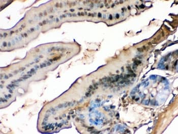 FABP1 / L-FABP Antibody