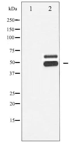 CaMKII Beta+Gamma+Delta Antibody (phospho-Thr287)