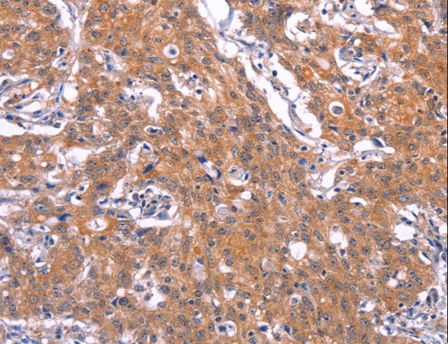 TNFRSF17 / BCMA Antibody