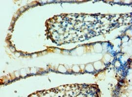 FAP Alpha Antibody (aa26-280)