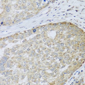 ANAPC10 / APC10 Antibody (AP)
