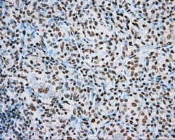 ARNT / HIF-1-Beta Antibody (clone OTI1A1)