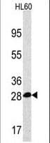 Polyclonal Rabbit anti-Human PSMA5 Antibody (aa106-135, IHC, WB)
