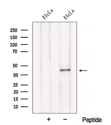 BCAT1 / ECA39 Antibody