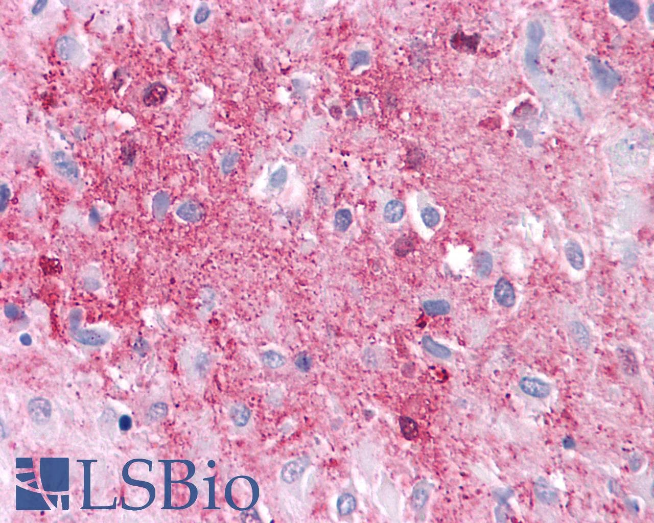 IHC-plus™ Polyclonal Rabbit anti-Human GPRC5A / RAI3 Antibody (Cytoplasmic Domain, IHC)