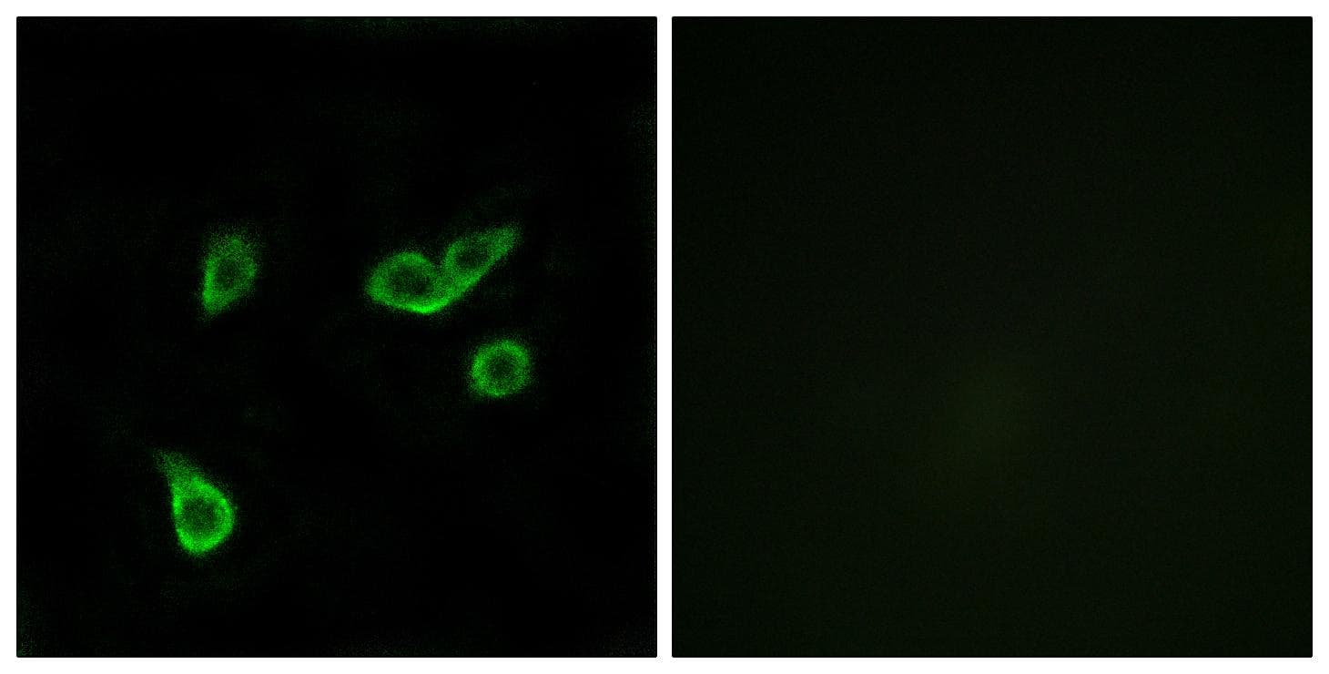 Polyclonal Rabbit anti-Human GPR35 Antibody (IF, WB)