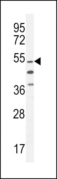 VWA9 / C15orf44 Antibody (aa358-386)