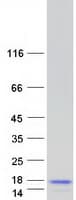 Human FAM195B Protein (Recombinant Myc-DDK (Flag))