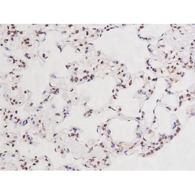 Polyclonal Rabbit anti-Human MAPT / Tau Antibody (phospho-Ser235, IHC, WB)
