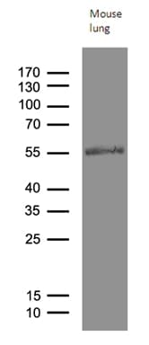 MOK / RAGE Antibody (aa205-419, clone OTI6C12)