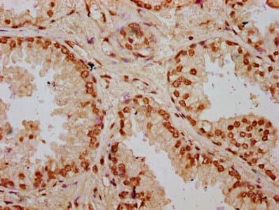HIST1H2BN Antibody