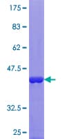 Human RBP5 Protein (Recombinant GST)