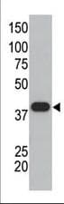 SUMO1 / SMT3 Antibody (aa55-86)