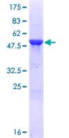Human CMBL Protein (Recombinant GST)