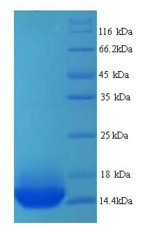 Human ADRB1 Protein (Recombinant His)