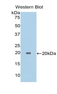 LGALSL / Galectin 5 Antibody (aa1-145)