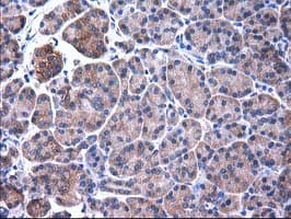 SULT1C2 / Sulfotransferase 1C2 Antibody (clone OTI4G1)