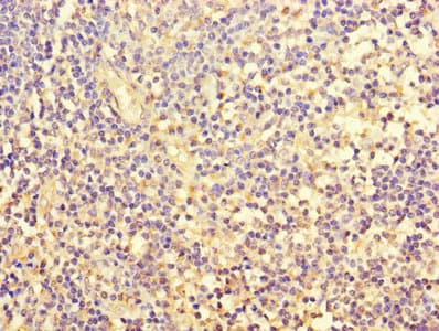 FOSL2 / FRA-2 Antibody